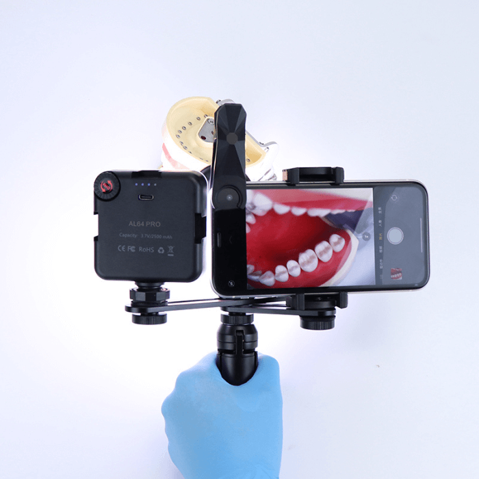 Equipo de fotografía dental con smartphone